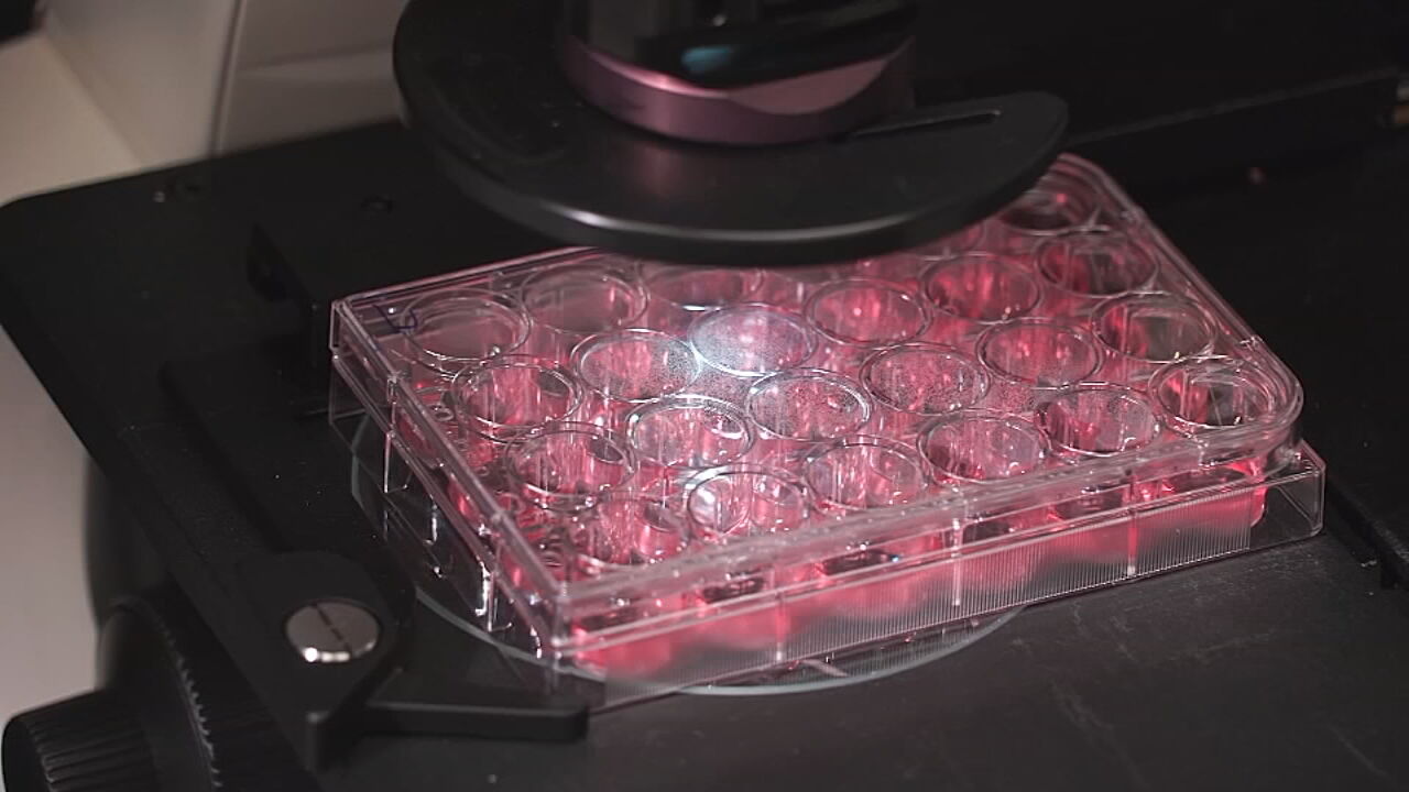 U OF L CO-IMMUNITY RESEARCH - COVID-19 FILE  (2).jpg